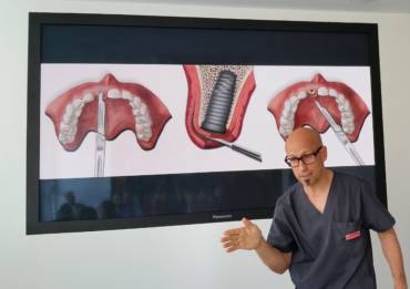 Zaawansowany kurs z zakresu technik chirurgicznych oraz implantologii estetycznej