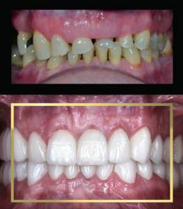 Metamorfoza uśniechu