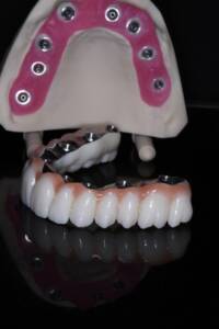 odbudowa protetyczna All-on-X