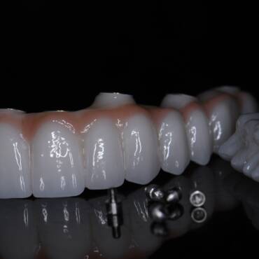 Protetyka Białystok | Metamorfoza uśmiechu w CZAR-DENT & CZAR-LAB