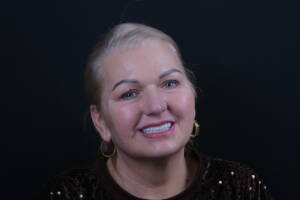 Zdjęcie twarzy Pacjentki po metamorfozie uśmiechu w Białymstoku