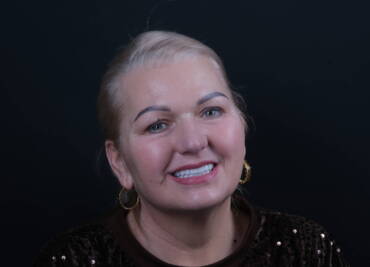 Metamorfoza uśmiechu All-on-X Białystok