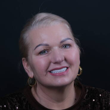 Metamorfoza uśmiechu All-on-X Białystok