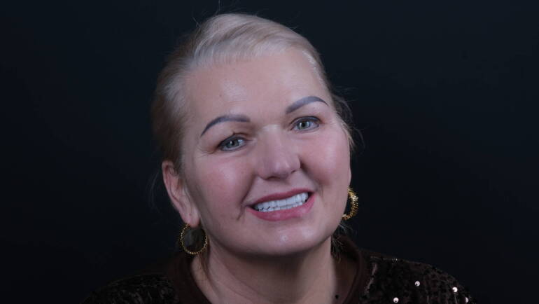 Metamorfoza uśmiechu All-on-X Białystok